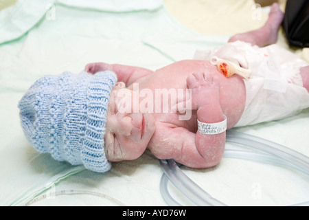 5 semaines d'un bébé prématuré secondes après être né Banque D'Images