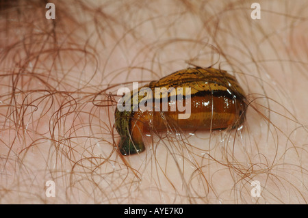 Un tigre Leech (Haemadipsa picta) sucer le sang humain dans la forêt pluviale de Bornéo Banque D'Images