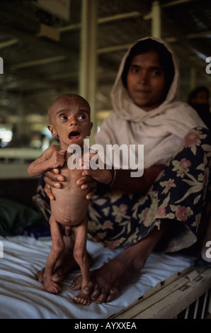 Musulmans Birmans réfugiés Rohyinga femme avec son enfant souffrant de malnutrition à l'hôpital à Cox's Bazaar, Bangladesh Banque D'Images