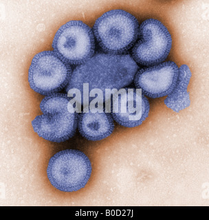 Vitraux négatif colorisée montrant les détails de l'ultrastructure TEM d'un certain nombre de particules de virus de la grippe Banque D'Images