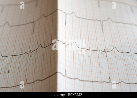 Close up d'un électrocardiographe Banque D'Images