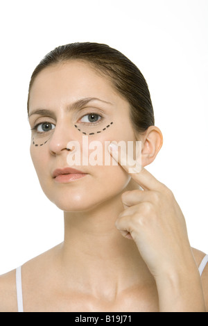 Femme pointant sur la chirurgie plastique des marquages sur joue, looking at camera Banque D'Images