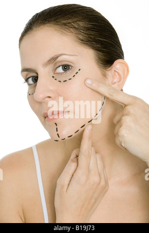 Femme pointant sur la chirurgie plastique marquage sur face, looking at camera Banque D'Images