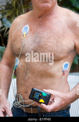 Moniteur / défibrillateur BEXEN CARDIO Reanibex 500 EMS - Médical