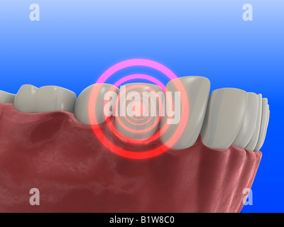 dent douloureuse Banque D'Images