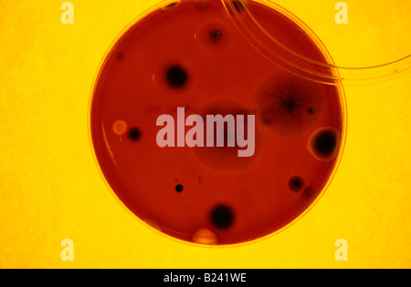 Pétri de culture sur gélose au sang contaminé Banque D'Images