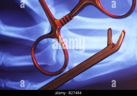 Collier CISEAUX ACIER INOXYDABLE X RAY IMAGE EN ARRIÈRE-PLAN Banque D'Images