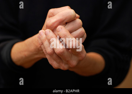 59-year-old woman's hands, symptômes de l'arthrite Banque D'Images