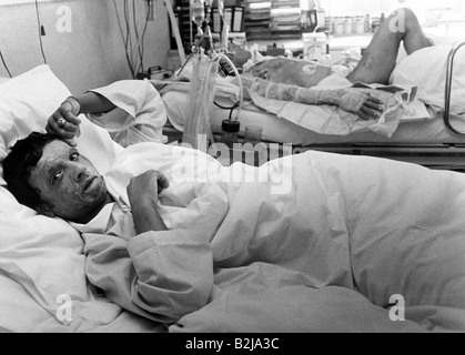 Événements, guerre Iran-Irak 1980 - 1988, par empoisonnement au gaz blessé homme dans un hôpital, Irak, vers 1985, victimes, guerre chimique, service médical, Iran, XXe siècle, historique, historique, peuple, années 1980, Banque D'Images