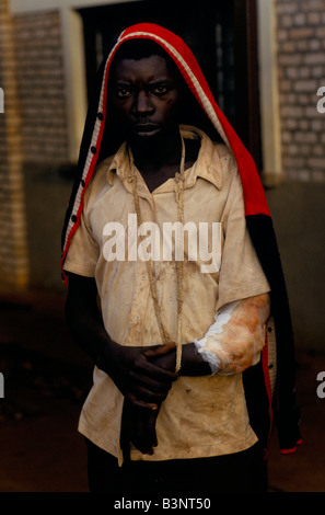 Les conflits ethniques DU BURUNDI", Nov 1993. Cet homme va PERDRE SON BRAS QUI A ÉTÉ presque coupée par une machette Banque D'Images