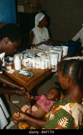 Votre médecin traitant au centre de santé de l'enfant blessé, le Burundi Banque D'Images