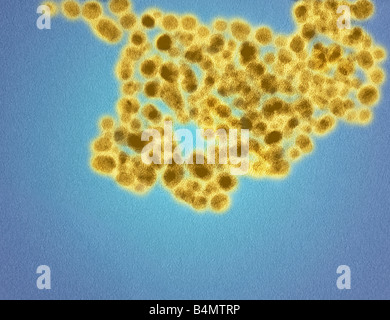 Une image TEM de nanoparticules d'or dans les cellules de revêtement de surface une glutathion corona illustrant la taille moléculaire de nanoparticules Banque D'Images