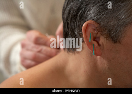 Femme acupuncteur l'application les aiguilles d'acupuncture sur l'oreille et le cou d'un homme adulte années 50 Banque D'Images