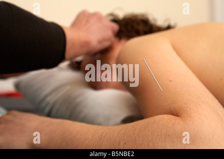 Les aiguilles d'acupuncture sur le coude et inséré dans le visage d'une femme adulte, fin des années 20 Banque D'Images