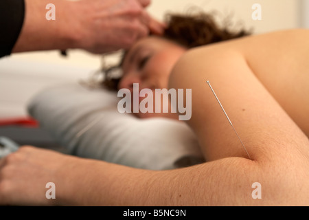 Les aiguilles d'acupuncture sur le coude et inséré dans le visage d'une femme adulte, fin des années 20 Banque D'Images