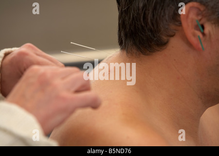 Femme acupuncteur l'application les aiguilles d'acupuncture sur l'oreille et le cou d'un homme adulte années 50 Banque D'Images