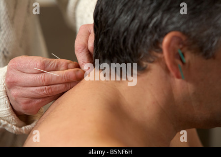 Femme acupuncteur l'application les aiguilles d'acupuncture sur l'oreille et le cou d'un homme adulte années 50 Banque D'Images