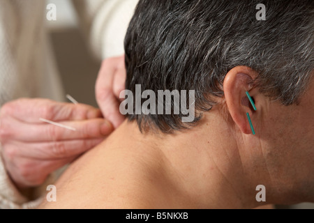 Femme acupuncteur l'application les aiguilles d'acupuncture sur l'oreille et le cou d'un homme adulte années 50 Banque D'Images