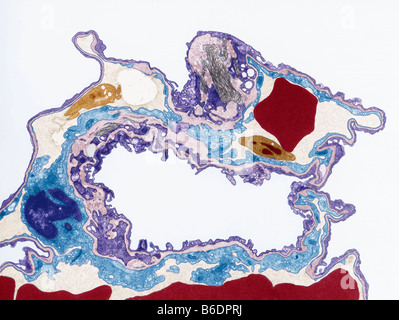 Le tissu pulmonaire, de couleur micrographie électronique à transmission (TEM) Banque D'Images