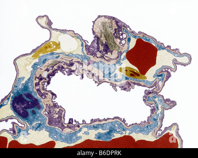 Le tissu pulmonaire, de couleur micrographie électronique à transmission (TEM) Banque D'Images