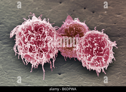 Les cellules de sang blanches. Couleur de l'analyse des électrons Microphotographie (SEM) de cellules de sang blanches des lymphocytes B Banque D'Images