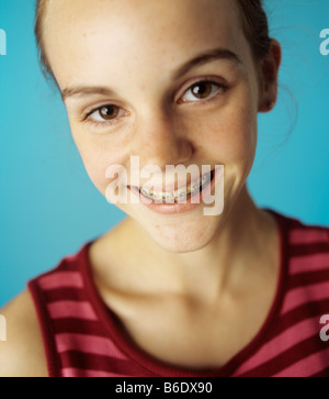 Appareil dentaire fixé sur les dents d'une jeune fille de 13 ans. Appareil fixe composé de supports métalliques cimentés à chaque dent. Banque D'Images