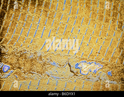 Faux-color micrographe(TEM) des muscles striés. Banque D'Images