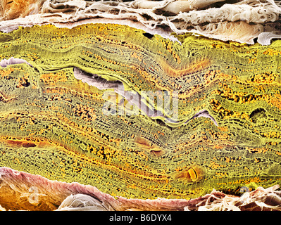 Le muscle cardiaque. Couleur de l'analyse des électrons Microphotographie (SEM) d'un ensemble d'musclefibrils cardiaque (vert) à partir d'un cœur en santé. Banque D'Images