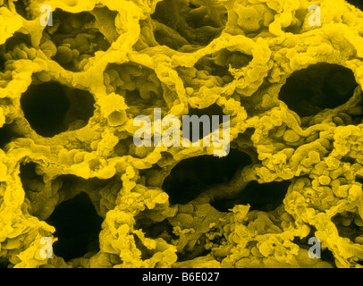 Faux-couleurs de l'analyse des électrons Microphotographie de asection de tissu pulmonaire sain. Banque D'Images