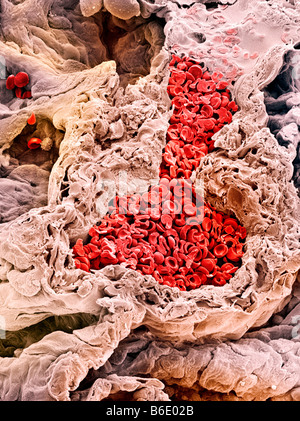 Les vaisseaux sanguins des poumons, couleur de l'analyse des électrons Microphotographie (SEM) d'un vaisseau sanguin autour d'alvéoles(air espace Banque D'Images