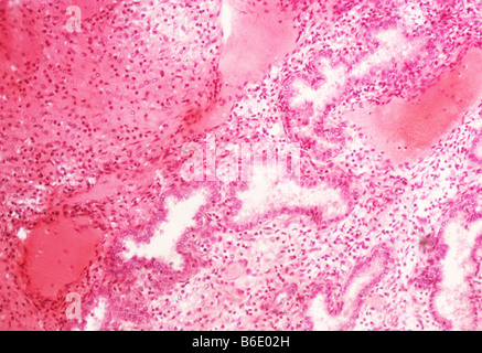 Endomètre, Light micrograph d'une section à travers un environnement humain de l'endomètre, le mucosallining de l'utérus. Banque D'Images