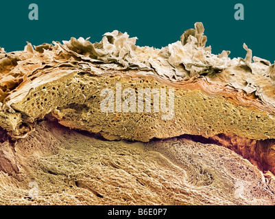 La peau. Couleur de l'analyse des électrons Microphotographie (SEM) d'une section à travers la peau saine. Banque D'Images