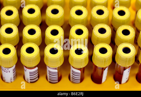 Des échantillons de sang. Tubescontaining vacutainer avec code barres des échantillons de sang Banque D'Images