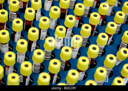 Des échantillons de sang. Tubescontaining vacutainer avec code barres des échantillons de sang Banque D'Images