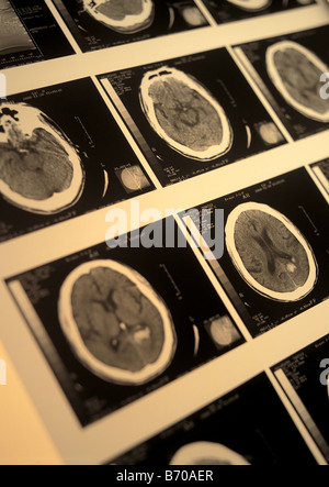 Close-up of X-ray Banque D'Images