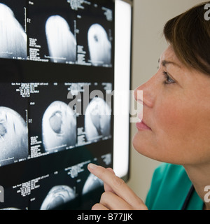 Close up of female technician examining x-ray Banque D'Images