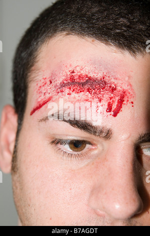 Maquette d'un accident de voiture victime qui frappé la tête sur le volant créé avec blessures constituent Banque D'Images