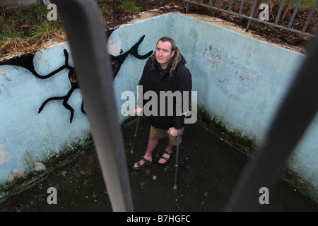 Un portrait d'un homme avec une cheville cassée qui attend depuis plus de 13 mois pour le n.h.s à exploiter à sa cheville pour réparer Banque D'Images