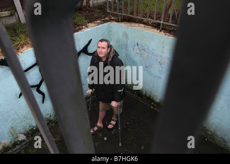 Un portrait d'un homme avec une cheville cassée qui attend depuis plus de 13 mois pour le n.h.s à exploiter à sa cheville pour réparer Banque D'Images