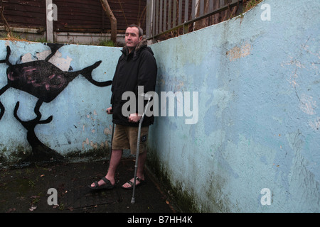 Un portrait d'un homme avec une cheville cassée qui attend depuis plus de 13 mois pour le n.h.s à exploiter à sa cheville pour réparer Banque D'Images