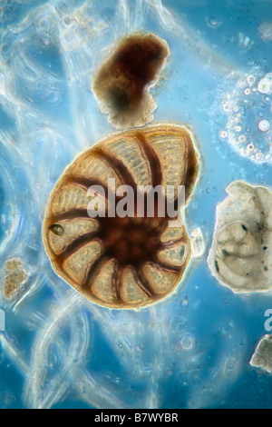 Soundings Port Fairy Victoria Australie montrant une petite variété de micro-organismes et les fossiles contenues. Banque D'Images