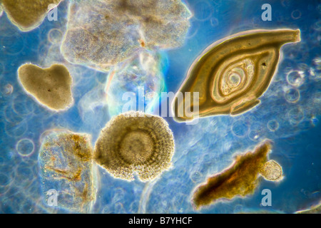 Soundings Port Fairy Victoria Australie montrant une petite variété de micro-organismes et les fossiles contenues. Banque D'Images