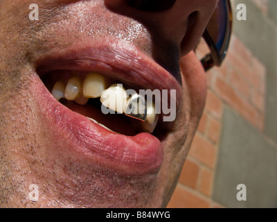 Portrait d'un homme avec de l'or avec dents plafonnés star shape design Banque D'Images