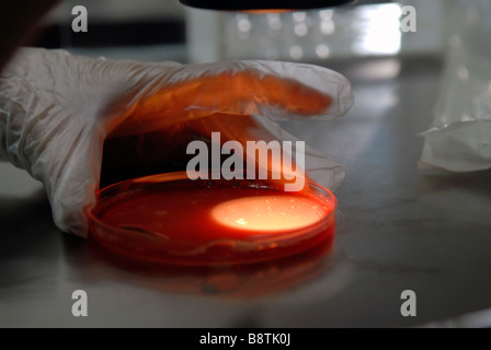 Placer sur un embryon embryologiste Boîte de culture au cours du processus de vitrification à la clinique de fertilité dans centre médical Sheba, à Tel Hashomer, Israël Banque D'Images