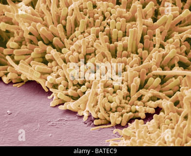 Les bactéries formant des scanningelectron, Microphotographie (SEM). La plaque dentaire est un biofilm de bactéries qui se forme sur les dents. Banque D'Images