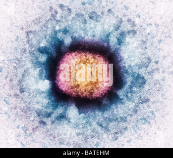 Des particules de virus de la vaccine (VV), colorés micrographie électronique à transmission (TEM). VV est composé d'un noyau d'ADN. Banque D'Images