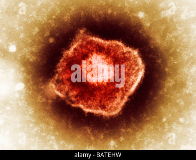 Virus varicelle-zona (VZV), particules micrographe de couleur (TEM). Le VZV n'est membre de l'herpès. Banque D'Images
