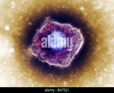 Virus varicelle-zona (VZV), particules micrographe de couleur (TEM). Le VZV n'est membre de l'herpès. Banque D'Images