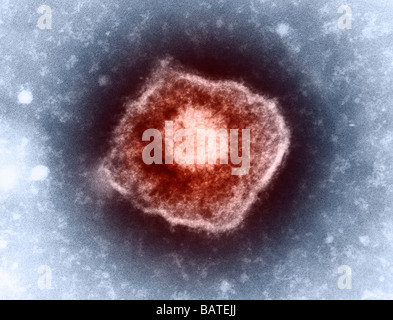 Virus varicelle-zona (VZV), micrographie électronique à transmission (TEM). Le VZV n'est membre de la famille de l'herpès et cause la varicelle. Banque D'Images