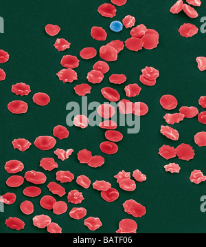 Les cellules de sang, couleur de l'analyse des électrons Microphotographie (SEM). Vu ici sont légèrement crenated (froissé) des globules rouges. Banque D'Images